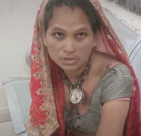 गले में जंजीर डाल खंभे से बांधा, गर्म सरिए से दागा: ताला तोड़ रात में 6 किमी पैदल चली महिला, बोली- पति ने क्रूरता की हद पार की