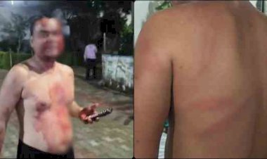 खून से लथपथ वकील ने अस्पताल में मचाया हंगामा, पुलिस की वर्दी भी खून से सनी: बुढ़ार में अधिवक्ता की पिटाई का आरोप, सिर फटा और कान में आई चोट; बीच-बचाव करने वाले साथी भी घायल